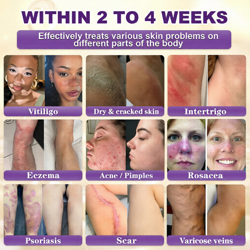 🔥QIAWI Biotin 10-in-1 Skin Restoration Cream
