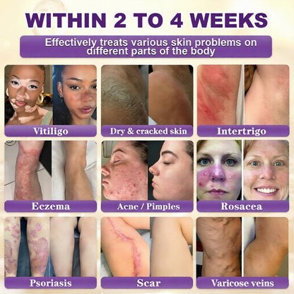 🔥QIAWI Biotin 10-in-1 Skin Restoration Cream