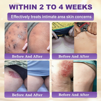 🔥QIAWI Biotin 10-in-1 Skin Restoration Cream