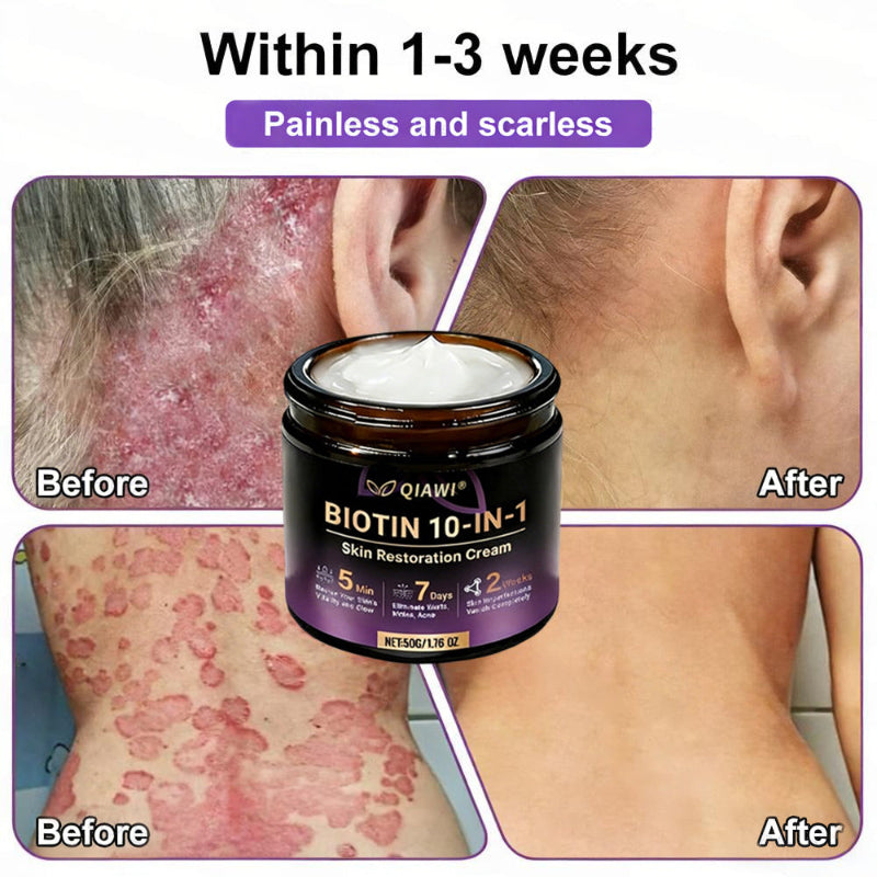 🔥QIAWI Biotin 10-in-1 Skin Restoration Cream
