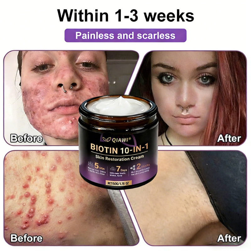 🔥QIAWI Biotin 10-in-1 Skin Restoration Cream