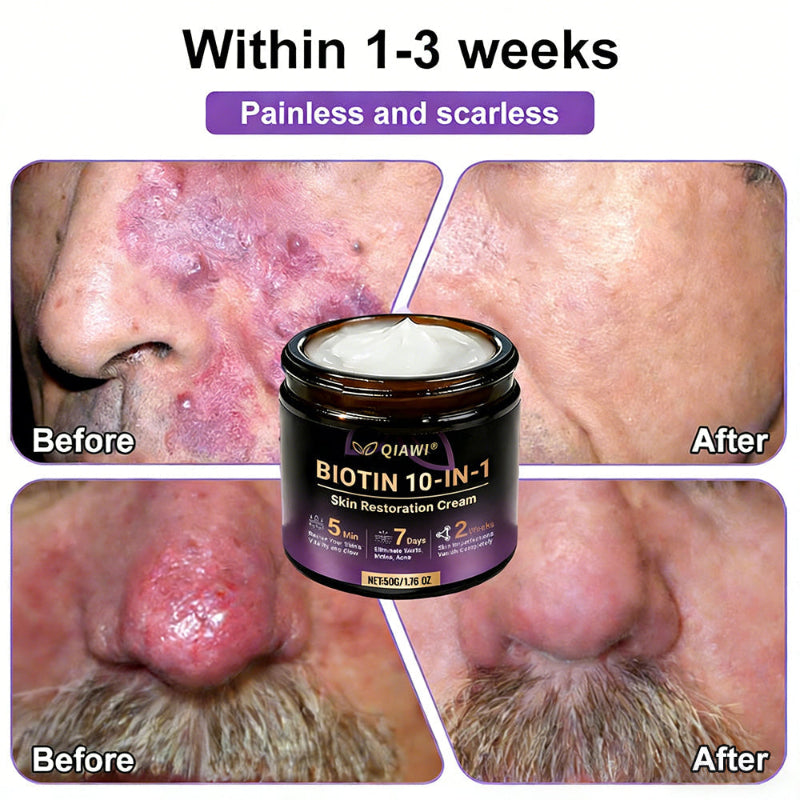 🔥QIAWI Biotin 10-in-1 Skin Restoration Cream