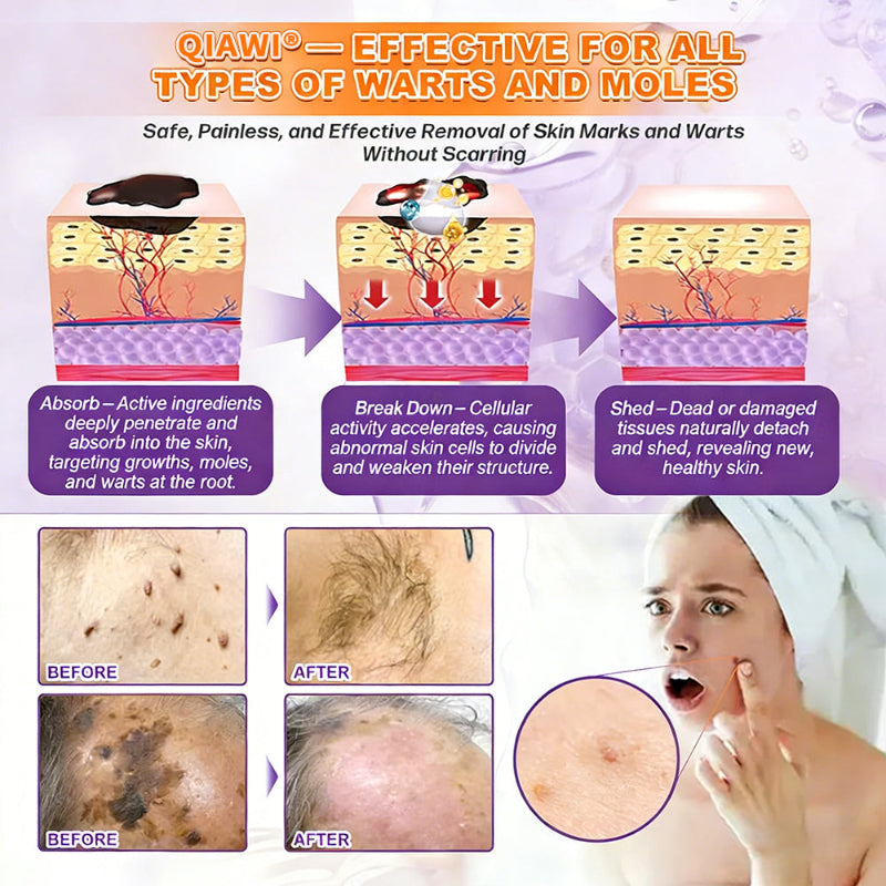 🔥QIAWI Biotin 10-in-1 Skin Restoration Cream