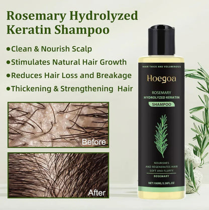 🔥Final 3 Hours: 70%OFF🔥Rosemary Hydrolyzed Keratin Shampoo-XDX-FB