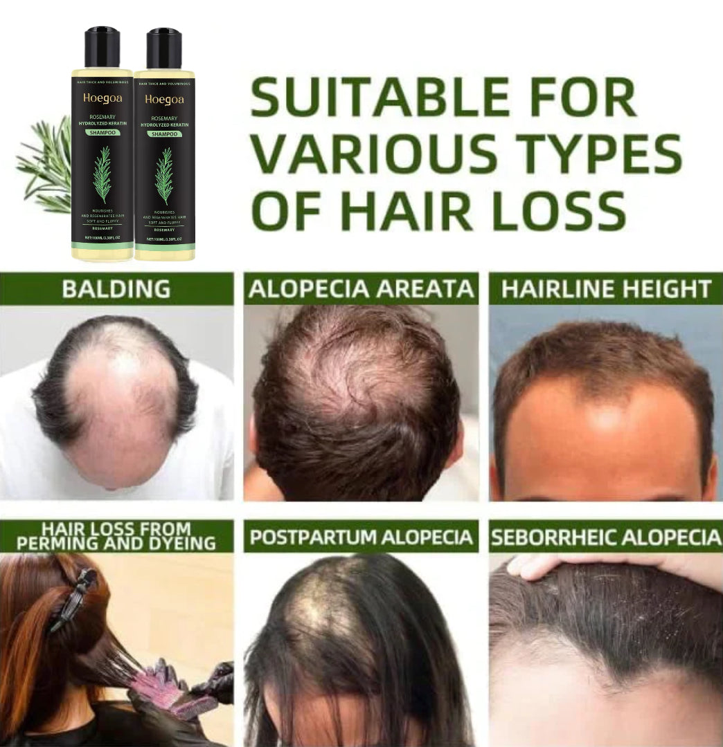 🔥Final 3 Hours: 70%OFF🔥Rosemary Hydrolyzed Keratin Shampoo-XDX-FB