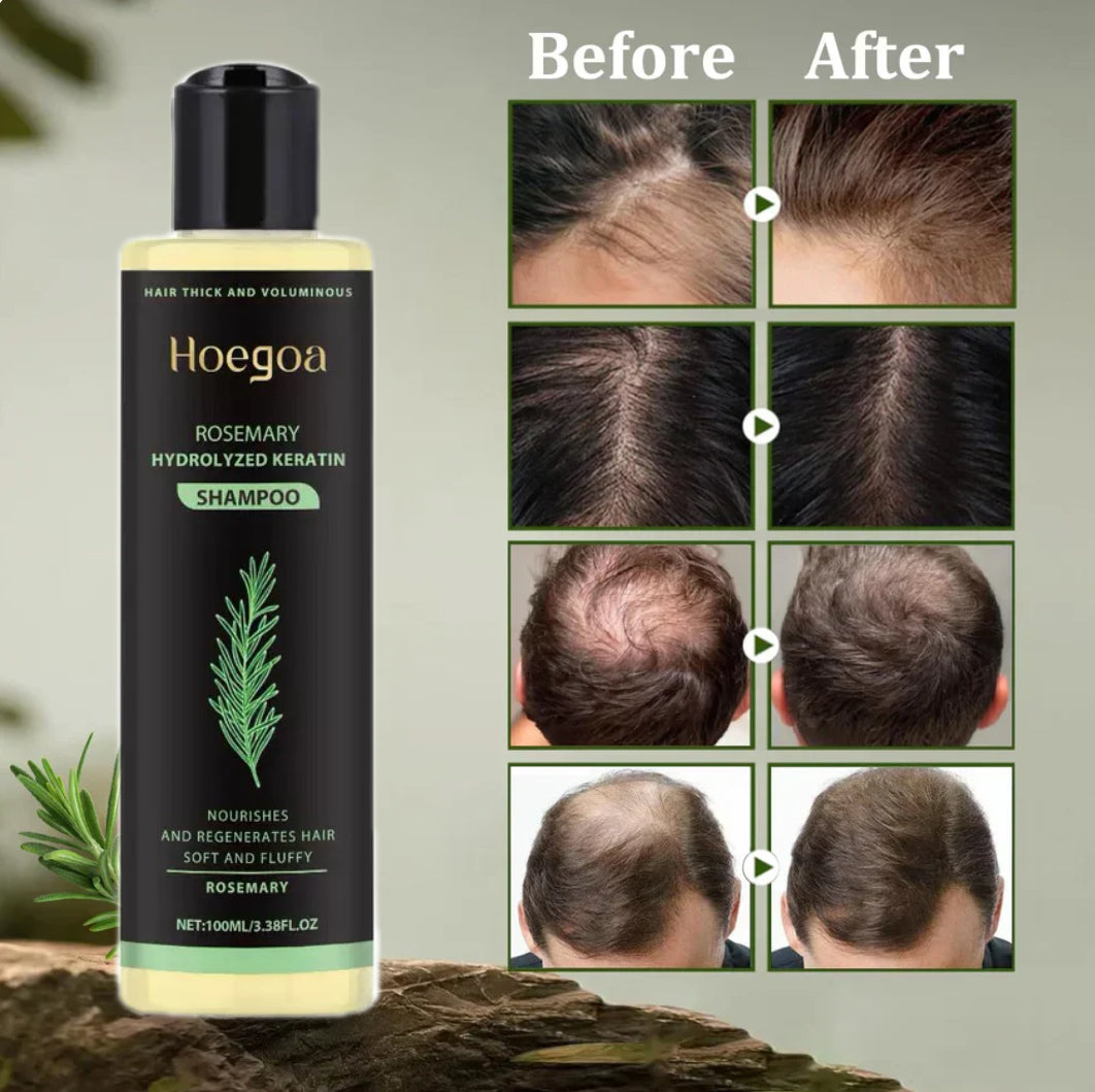 🔥Final 3 Hours: 70%OFF🔥Rosemary Hydrolyzed Keratin Shampoo-XDX-FB