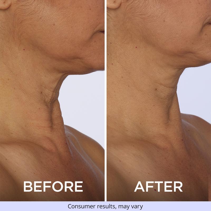 Imeebo Spring Sale  Tighten & Lift Firming Cream for Crepey Skin