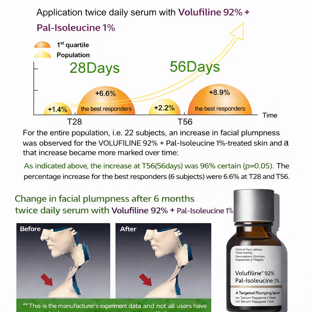 Volufiline 92% + Pal-Isoleucine 1% Advanced Plumping Formula for Hollow & Sagging Areas