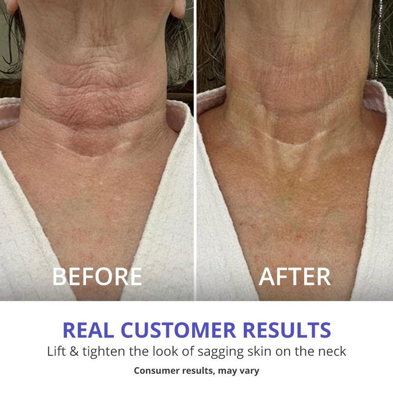 Imeebo Spring Sale  Tighten & Lift Firming Cream for Crepey Skin