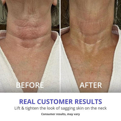 Imeebo Spring Sale  Tighten & Lift Firming Cream for Crepey Skin