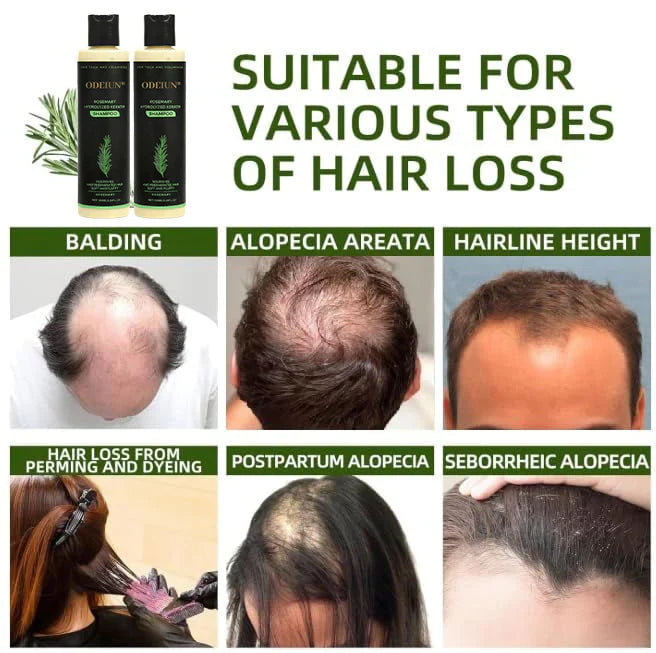 🌱 Organic Rosemary Hair Growth Shampoo